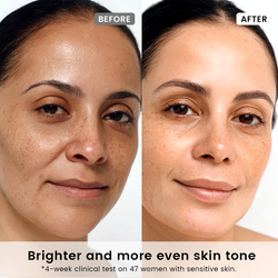 Radiance Recovery Set