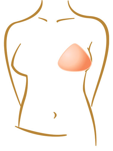 American Breast Care Lightweight Triangle Shaper - CureDiva