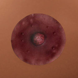 Dark-Colored Nipples